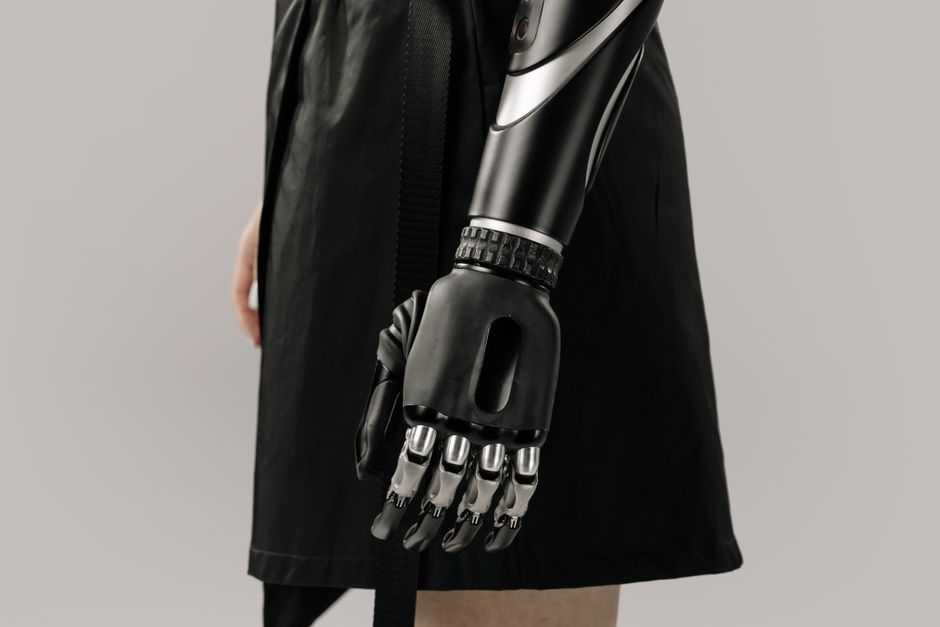 A contemporary image showcasing an elegant black prosthetic arm on a woman, highlighting modern technology.